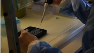 3. dozda uygulanan Biontech aşısı Sinovac'a göre...