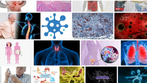 Sağlık Bakanı Koca: "Belirtileri Covid-19'a benzeyen enfeksiyonlarda ciddi artış var"