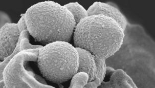 Bakanlıktan Strep-A Uyarısı