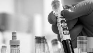 Demans ve ALS Hastalarına Umut Olacak Çalışma